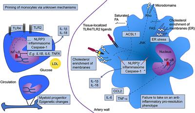 Monocytes and Macrophages as Protagonists in Vascular Complications of Diabetes